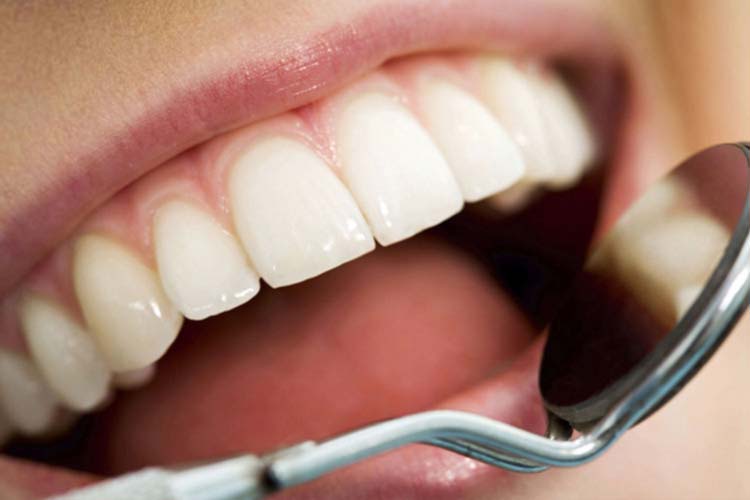 Maybe it’s time to consider veneers for your damaged tooth!