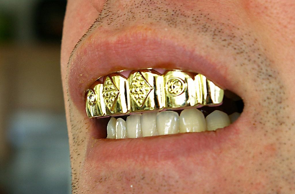 From gold to plastics – A short history of implantology